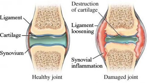 Joint Pack (MSM & Glucosamine)